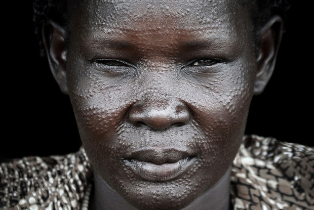 In the words of 40 year old Nyakat Chatim (2014), "I rushed from Sudan with nothing, but my 5 children. The war had intensified more than we expected. Life is not very easy here, but we are trying our best to make it happen."I met Nyakat in 2014, in Kiryandongo refugee settlement, following the Civil War in South Sudan that broke up the previous year, following a political struggle between Kiir and Machar that led to Machar
