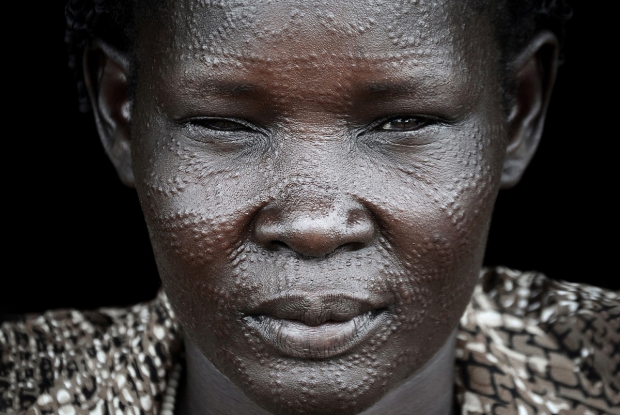 In the words of 40 year old Nyakat Chatim (2014), I rushed from Sudan with nothing, but my 5 children. The war had intensified more than we expected. Life is not very easy here, but we are trying our best to make it happen. I met Nyakat in 2014, in Kiryandongo refugee settlement, following the Civil War in South Sudan that broke up the previous year, following a political struggle between Kiir and Machar that led to Machar's removal as vice president. On July 9, 2011, South Sudan gained its long-fought independence from Sudan. Since then, the new country descended into a bloody civil war, and while a peace deal was inked by warring parties in 2018, human rights abuses, fighting between communities, as well as government rages on. (as of 2022)