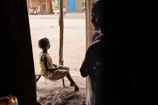 In Kyaka settlement-Uganda, this little girl continues to agonizingly grow through the scars of cruelty done to her by her father in revenge for a misunderstanding with her mother. The little girl's mother narrates, between sobs, how her husband turned his anger into the despicable. He forcibly tied a rope around his own daughters' limbs so tightly that the rope ate onto the poor child's fragile flesh day by day, sinking and rotting in for over a week. She was rescued later when the rope had cut through her limbs, denying her a chance to ever walk. Her father was jailed but soon escaped to kill them both. They ran for their lives and abandoned their home in Congo to find refuge in Uganda. &copy; Jjumba Martin, Chance for Childhood.